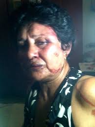 Photo by Ailer Gonzalez. “Violence has reached critical levels in Cuba,” says activist Antonio Rodiles, and actress Ana Luisa Rubio, 62, just experienced it ... - IMG_0020