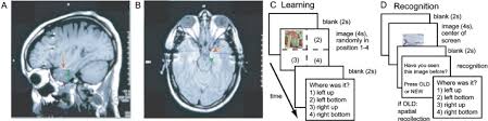 Single-Trial Learning of Novel Stimuli by Individual Neurons of the ...