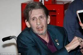 Image result for shane macgowan drunk