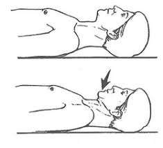 Chin Tucks - Improve Posture