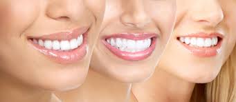 Image result for beautiful teeth