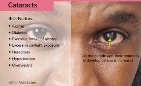 Image result for cataracts