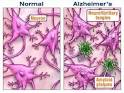 Omega-3s cross blood-brain barrier in Alzheimeraposs patients