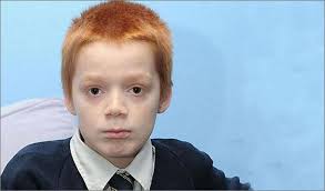 ... hindered Ronald McDonald&#39;s career—or Chris Evans&#39; for that matter—but being a red-headed British boy is nothing short of a nightmare for Tyler Walsh. - ginger_hair