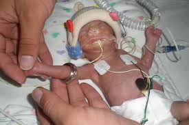Image result for images of small baby in nicu