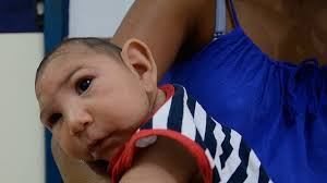 Image result for images of zika babiers