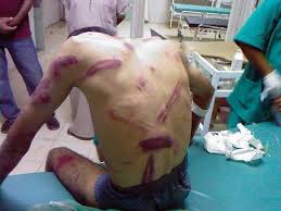 نتيجة بحث الصور عن السعودية والتعذيب