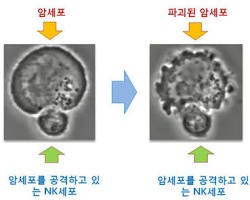 NK 세포와 암세포 이미지