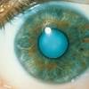 Story image for eye cataracts dissolve amyloid from Smithsonian